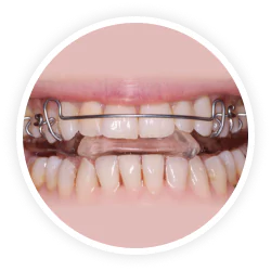 Better Mouth