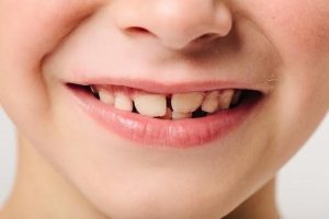 crooked-bottom teeth